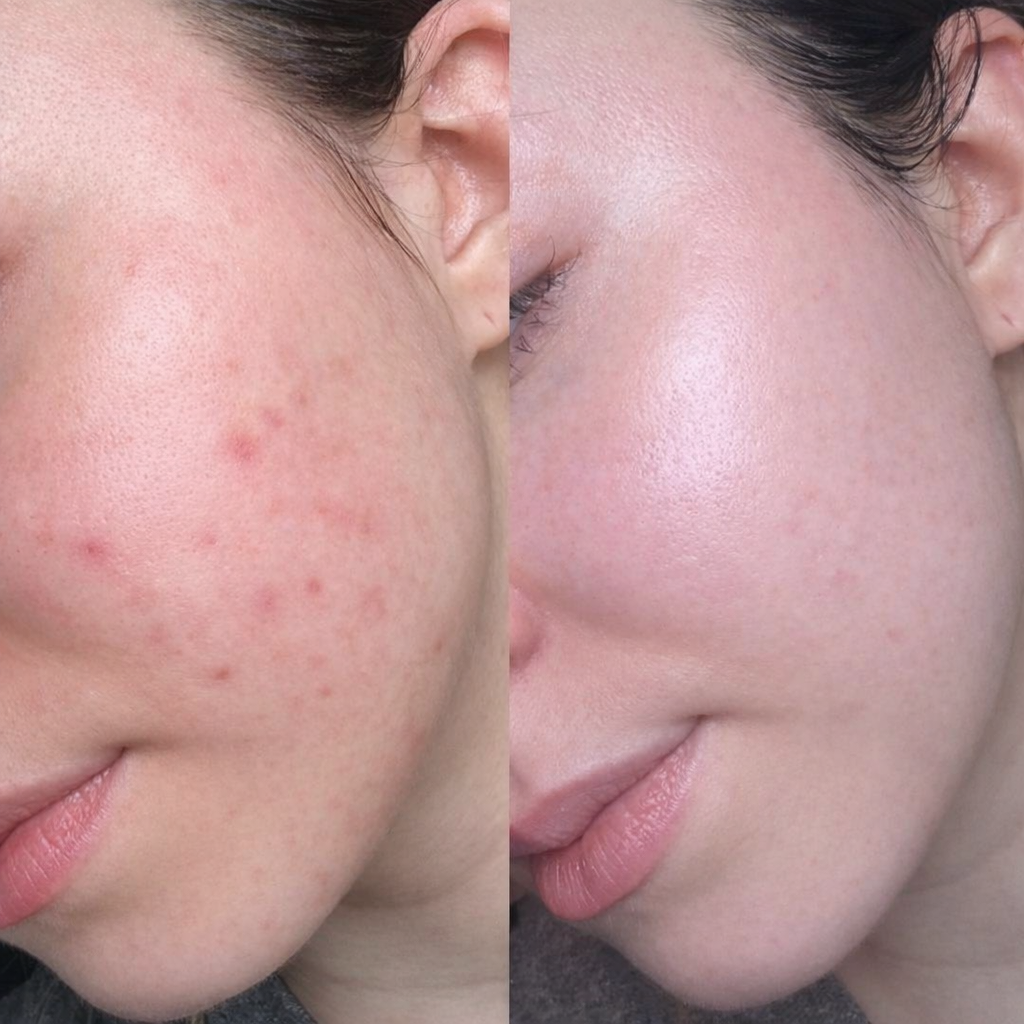 Before & After foto 1
